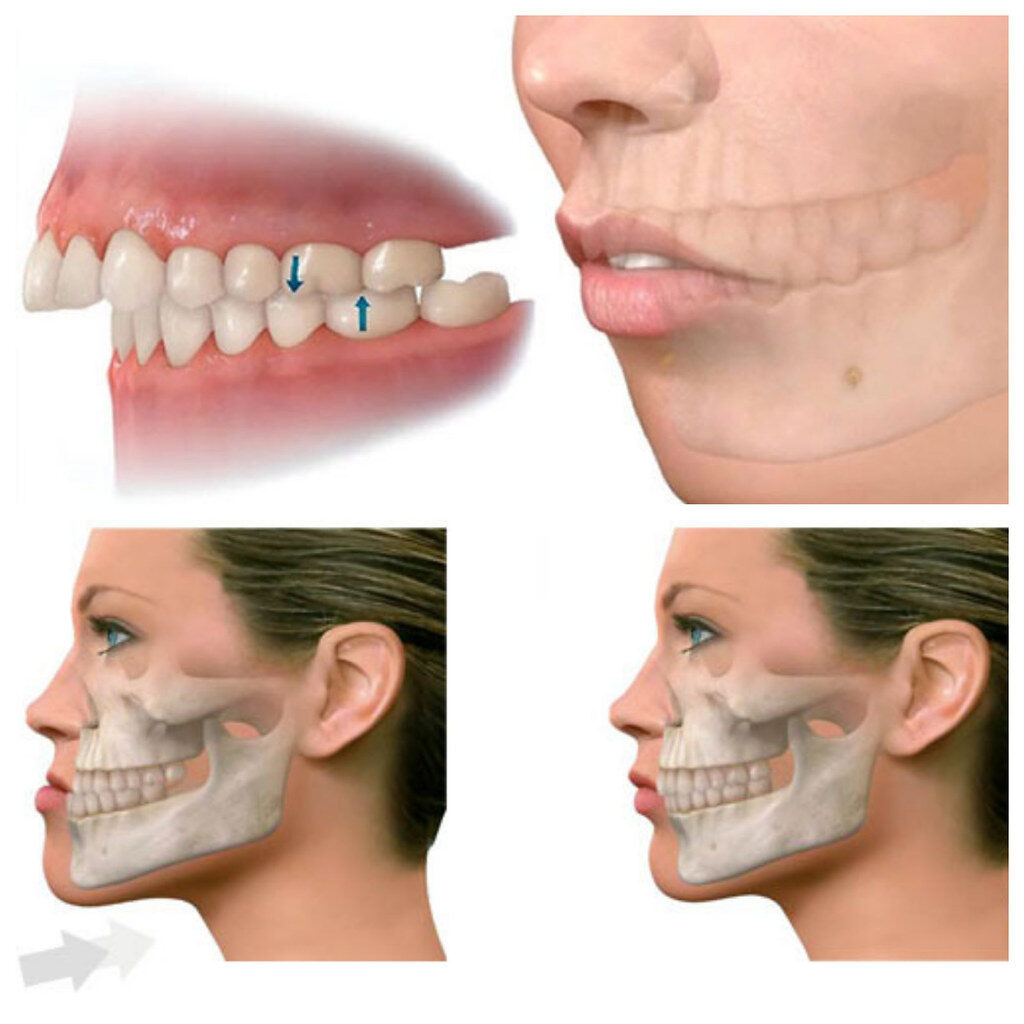 Cirugía oral y maxilofacial