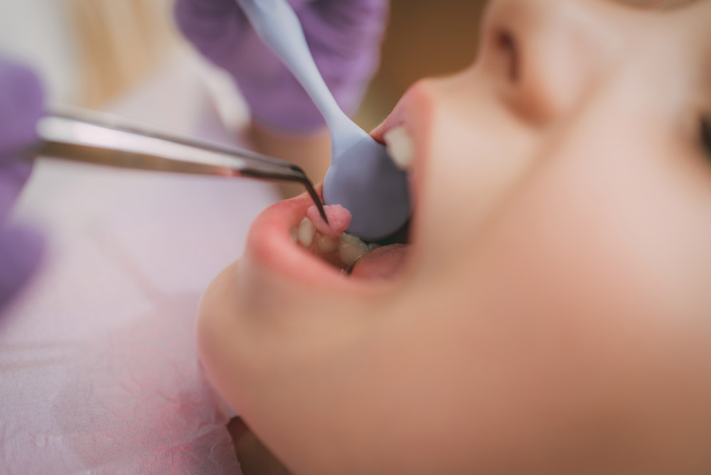 dentista infantil en Tarragona